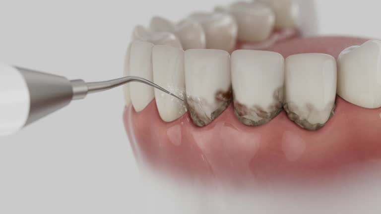 Trusted Teeth Cleaning And Checkup service in Sumner, WA - Dentist Open Now